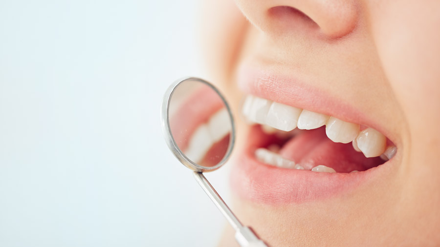 Tooth Extractions In Toronto