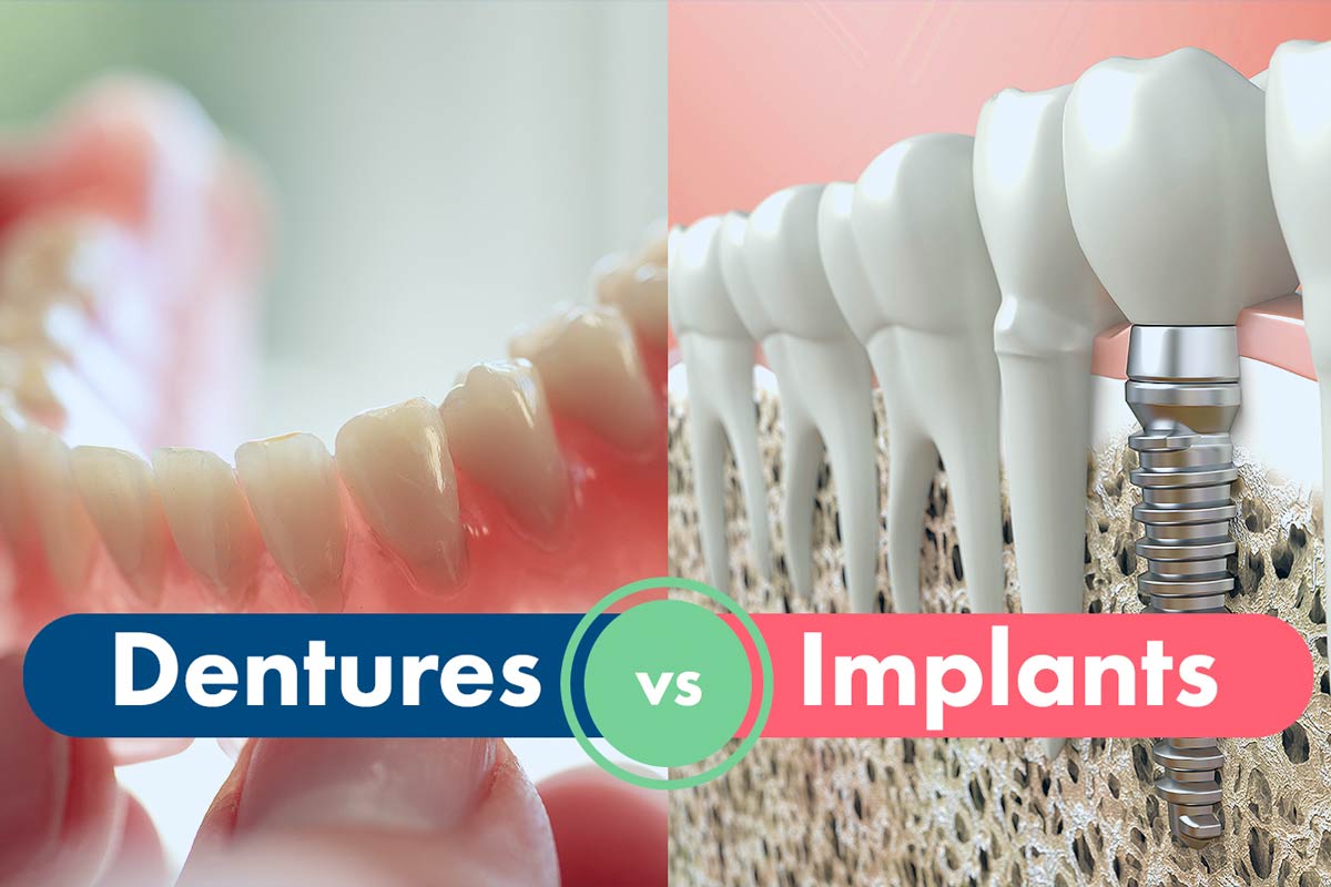The Best Dentures and Dental Implants in Summerhill,