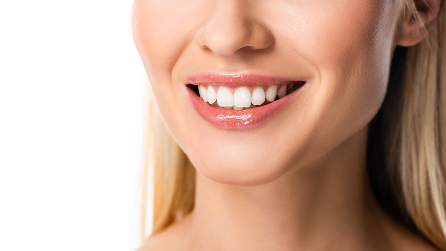 A woman with a bright smile, showcasing her dental veneers