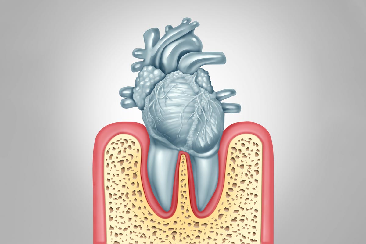 The Connection Between Oral Health and Heart Disease By Zara Dental