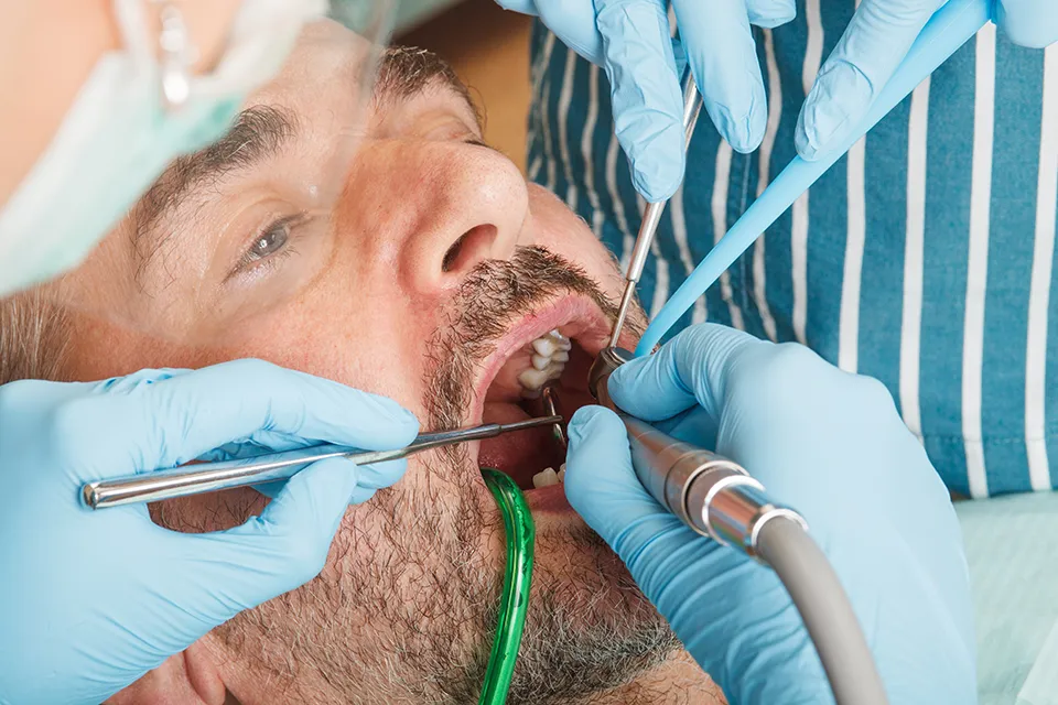 Affordable Tooth Extraction Treatment in Summerhill, Ontario