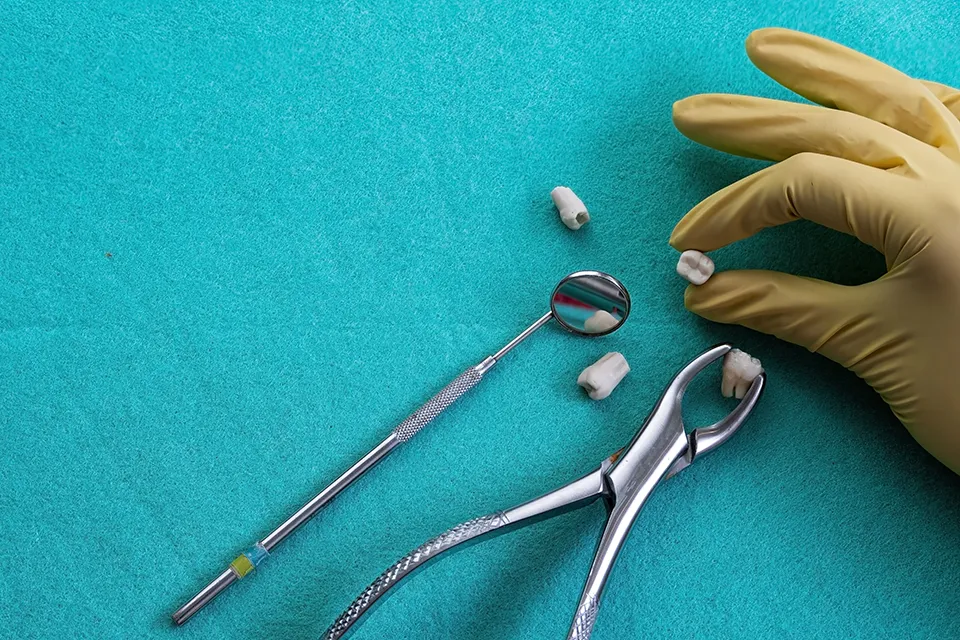 Signs You Might Need a Tooth Extraction: Recognizing Dental Issues