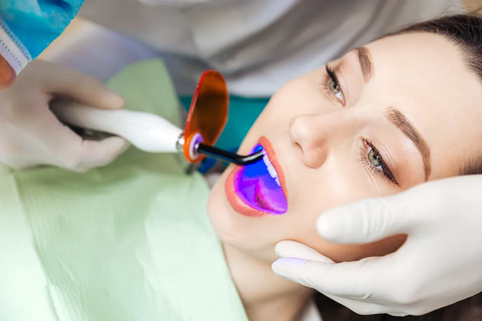 Signs You Need a Dental Filling- Recognizing Tooth Decay