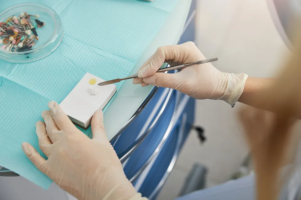 The Best Material for Dental Fillings