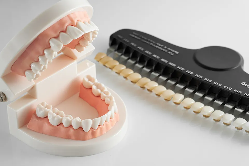 The Main Difference Between Veneers and Crowns