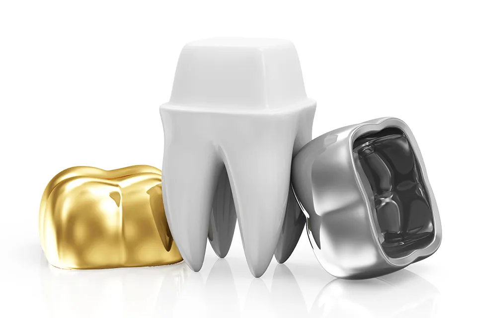 A Comprehensive Guide to Crown Material