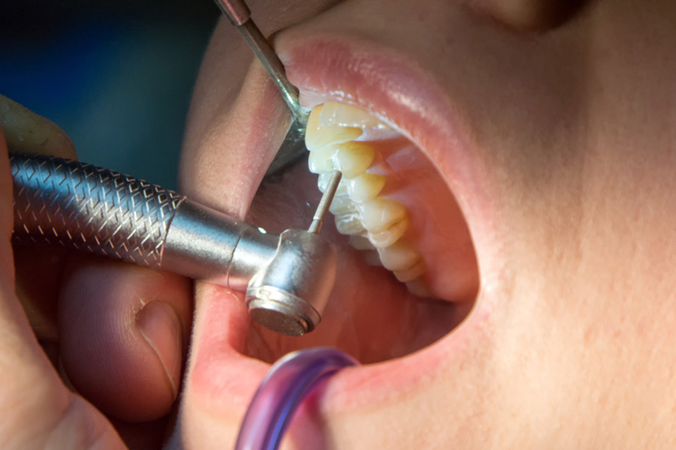 Understanding Endodontic Surgery: An In-depth Look