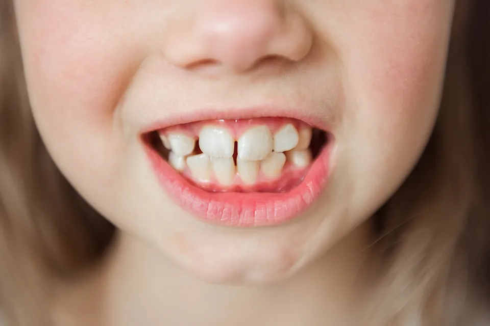 Family Dental Care: Oral Health for Your Loved Ones