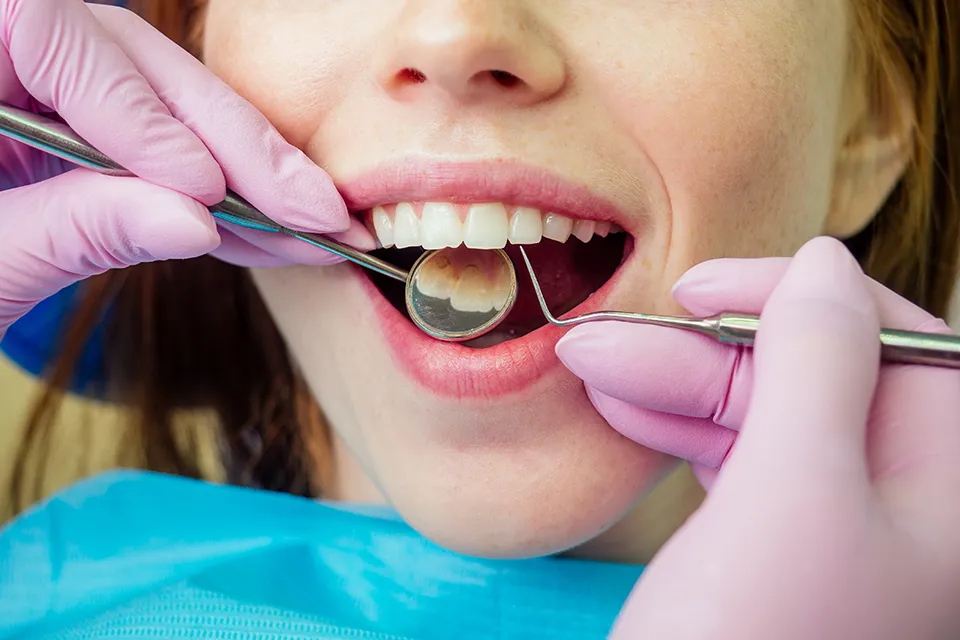 Plaque Removal: Essential Guide for Healthy Smiles