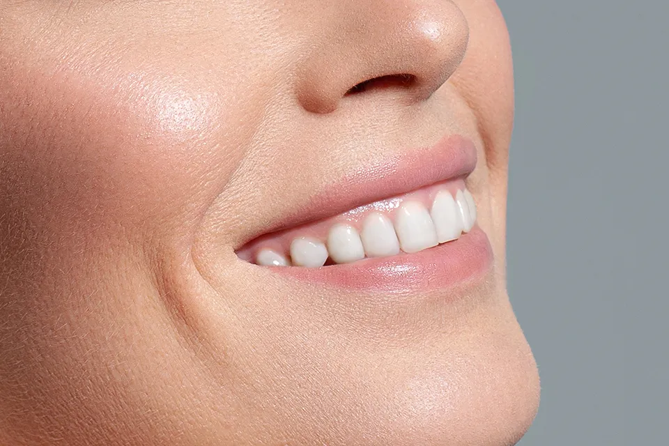 The Complete Guide to Cosmetic Dental Procedures