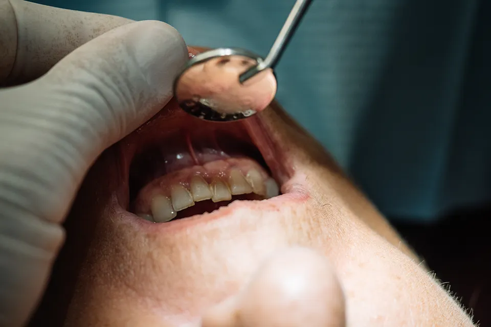 Understanding Receding Gums and Periodontics