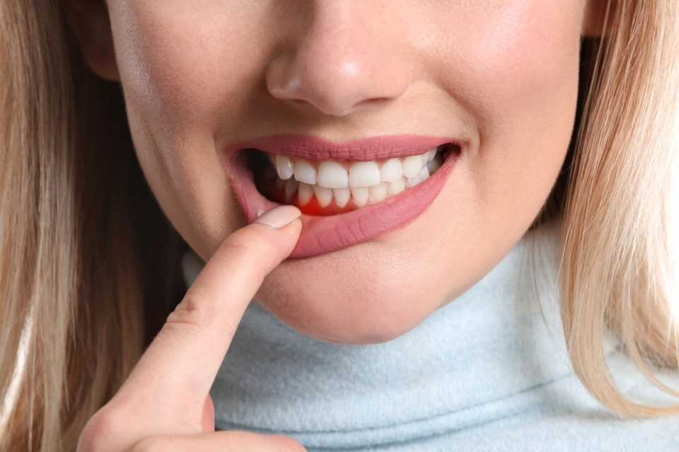 Understanding Non-Surgical Periodontal Treatment