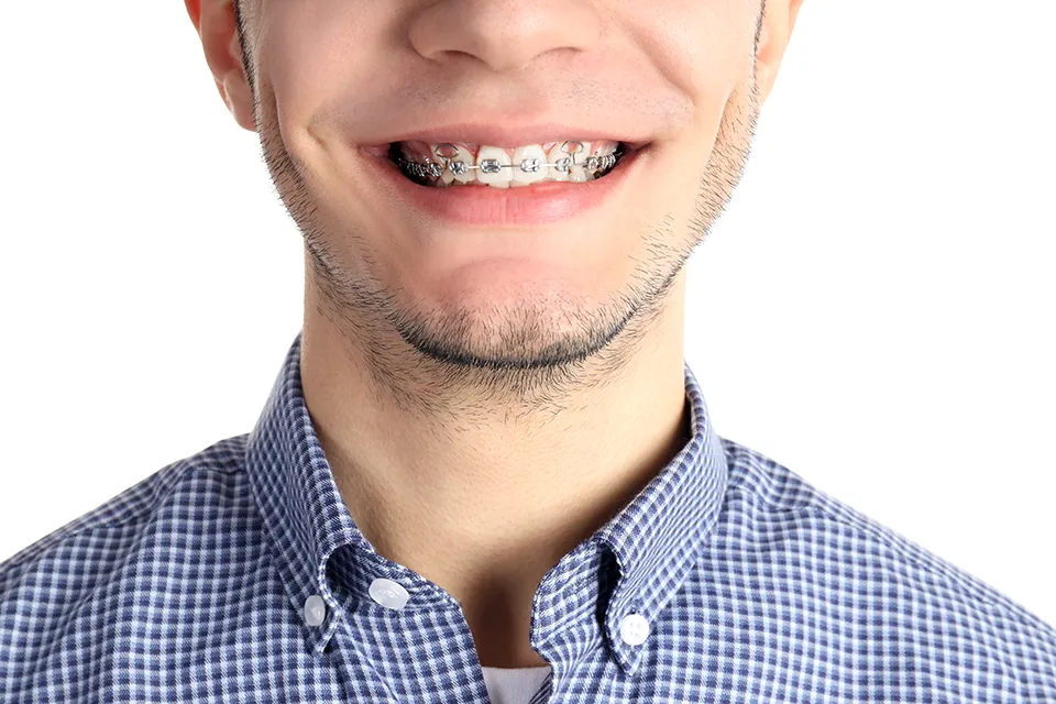 Orthodontic Treatment: What You Need to Know
