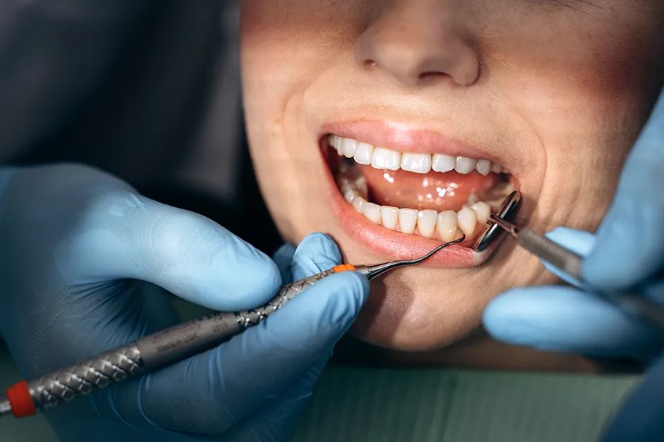 Understanding Non-Surgical Periodontal Treatment