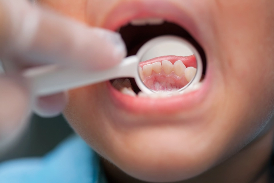 Dental Exam for Children: Ensuring Healthy Smiles from an Early Age