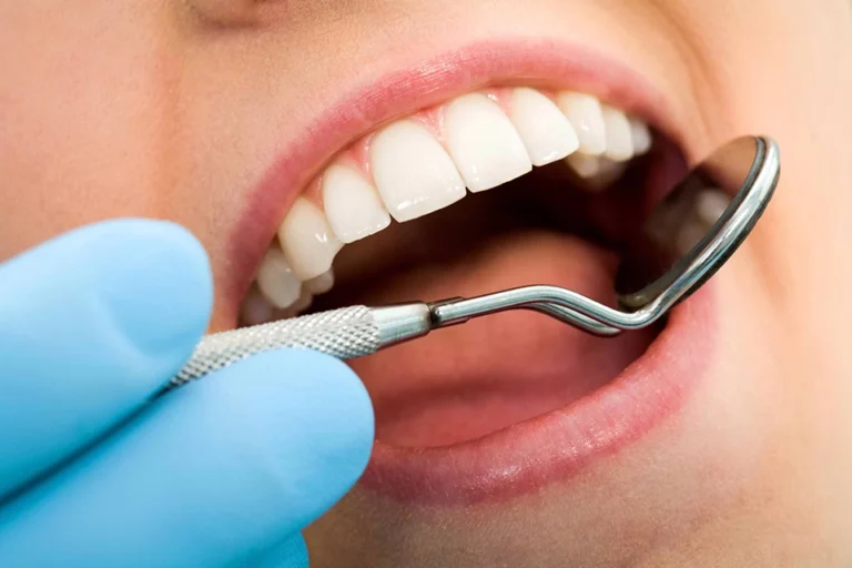 The Importance of Regular Dental Checkups