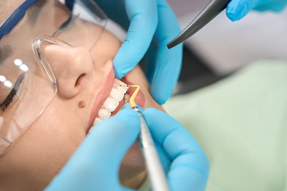 Scaling and Root Planing Procedure: Everything You Need to Know