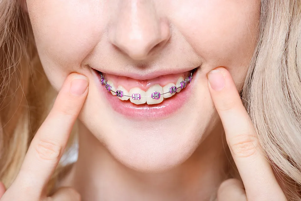 Why Choose Dental Land in Rosedale?