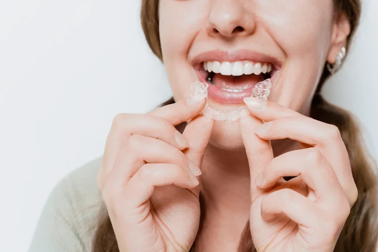 Clear Aligners vs. Traditional Braces: Which is Right for You?