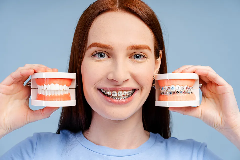 Clear Aligners vs. Traditional Braces: Which is Right for You?