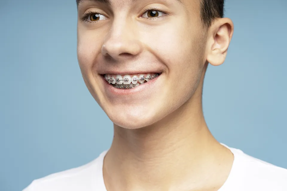 What is Orthodontic Treatment for Crooked Teeth?