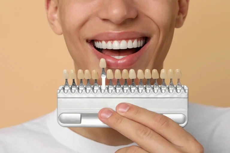 Dental Veneers vs. Teeth Whitening