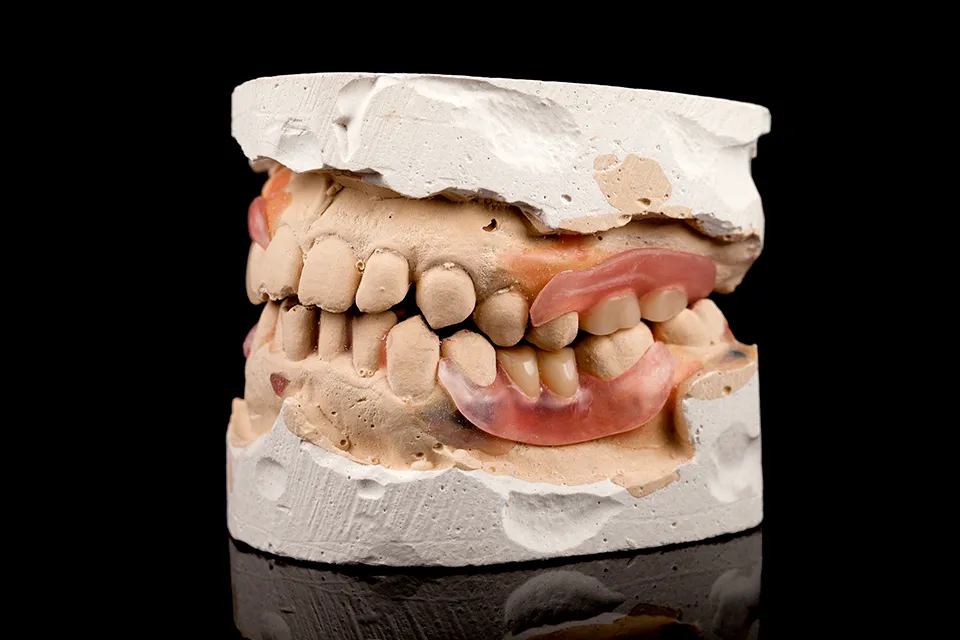 Types of Dental Bridges: A Comprehensive Guide