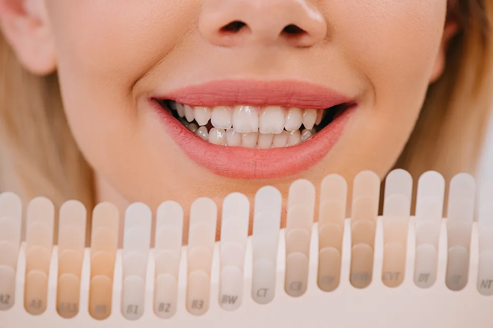 Dental Crown Materials: Choosing the Best Option for Your Smile