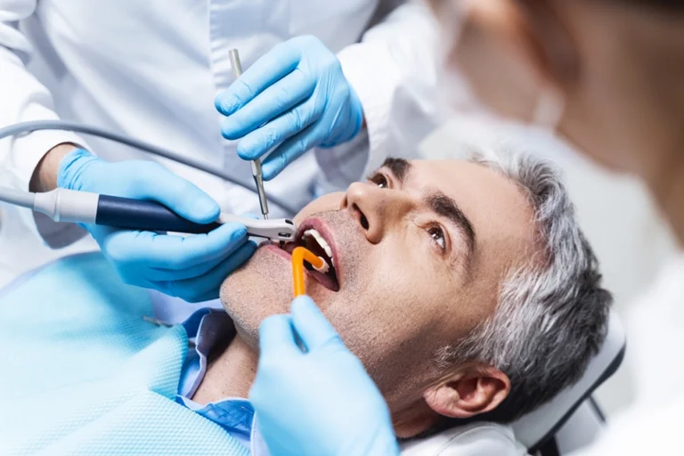 7 Benefits of Root Canal Over Extraction