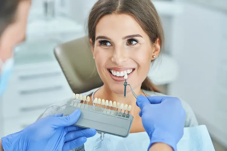How Long Do Porcelain Veneers Last? A Guide.