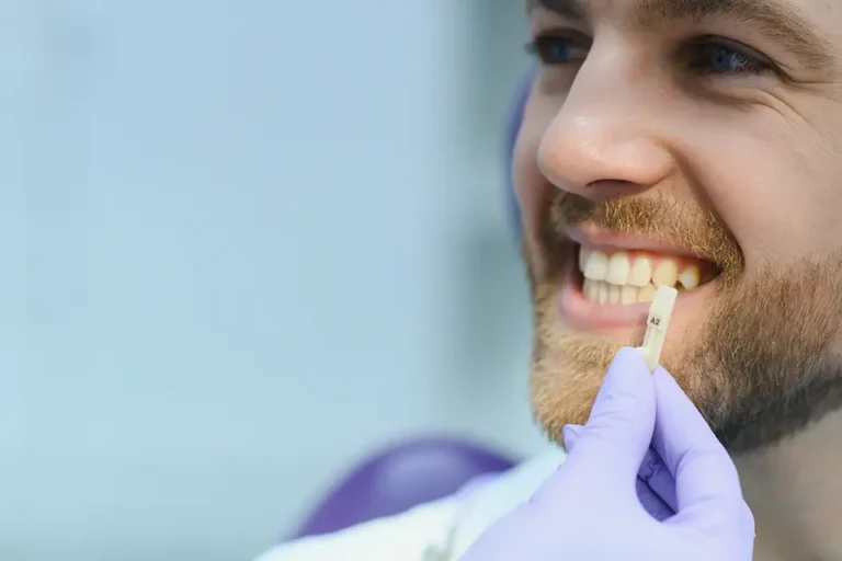 What Are the Disadvantages of Porcelain Veneers? A Detailed Guide