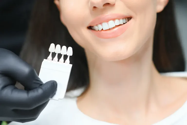 Porcelain Veneers for Crooked Teeth: A Modern Solution in Summerhill