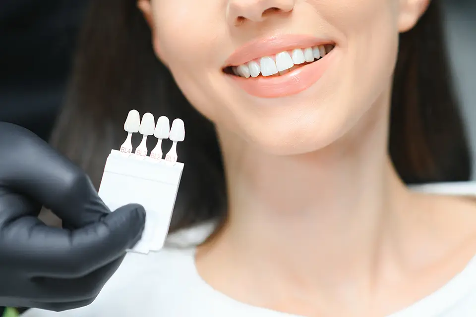 Porcelain Veneers for Crooked Teeth: A Modern Solution in Summerhill