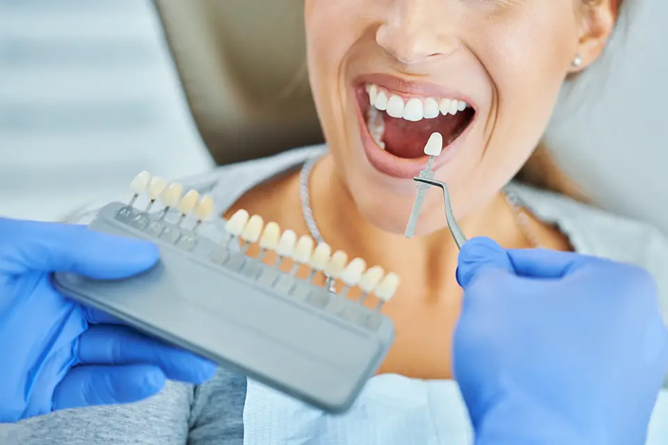 Porcelain Veneers vs Composite Veneers: Which Is Right for You?