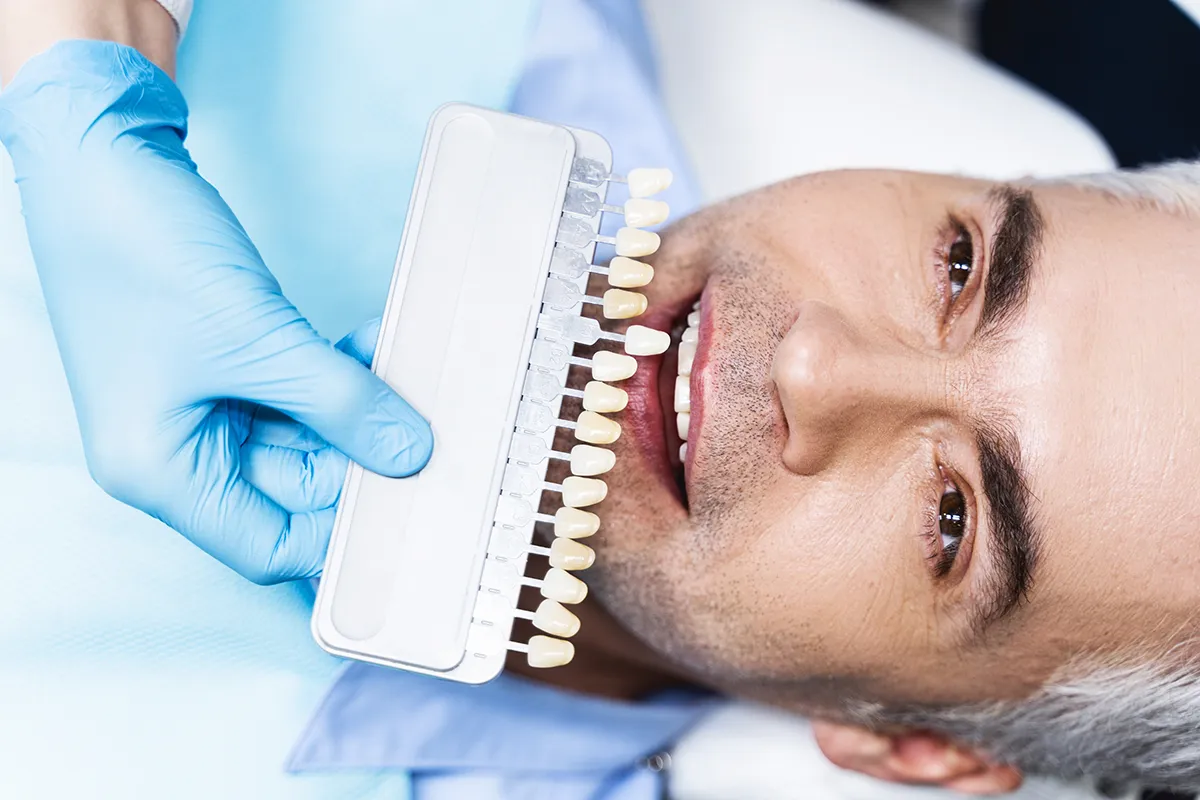 Dental Crowns