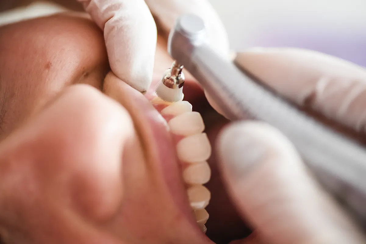 Dental Exams in Toronto