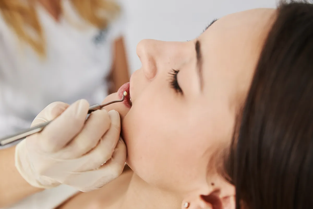 Dental Fillings
