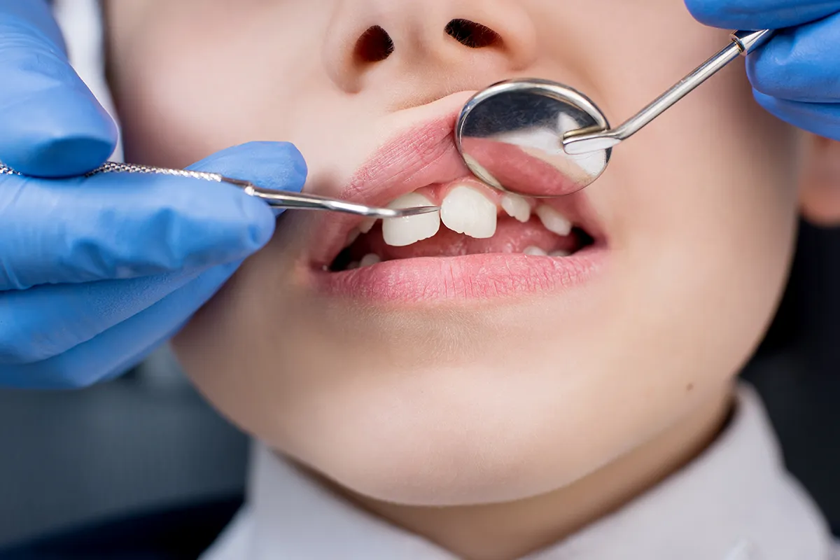 Pediatric Dentistry