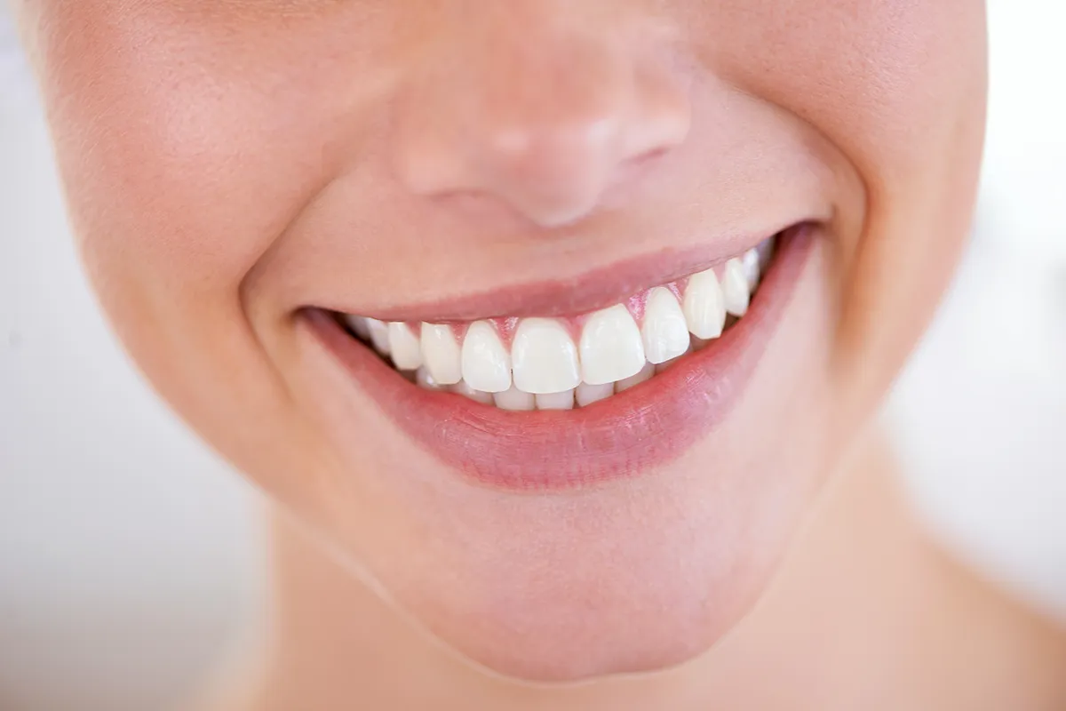 Teeth Whitening in Toronto