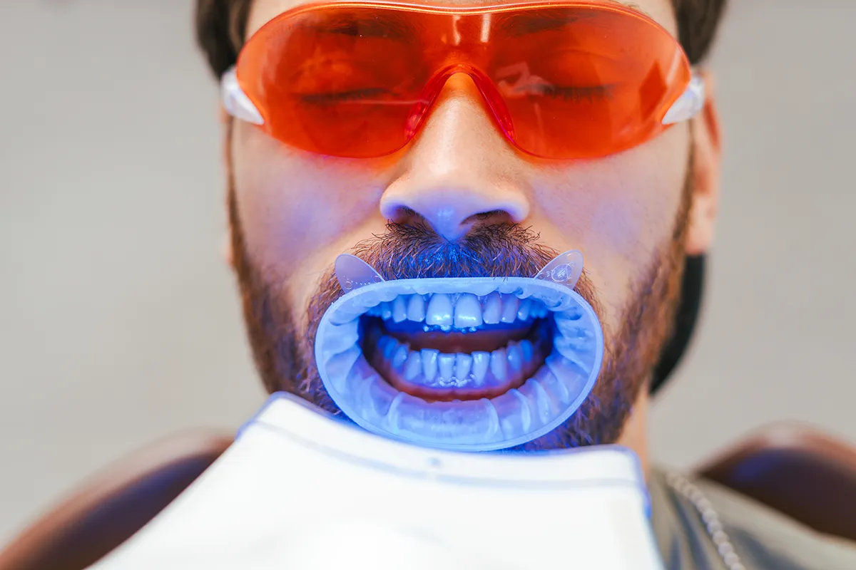 Teeth Whitening in Toronto