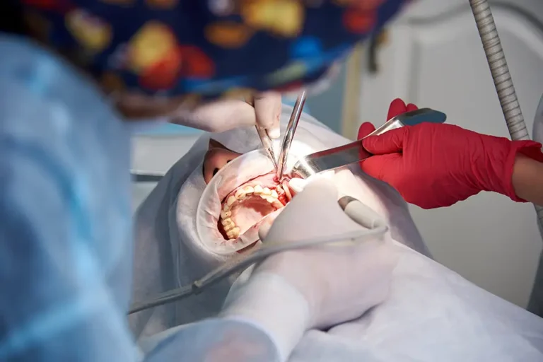 Apicoectomy vs Root Canal: Understanding Your Treatment Options