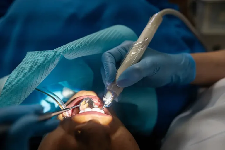 Why Don't You Wait? 5 Critical Signs You Need Third Molar Extraction Now