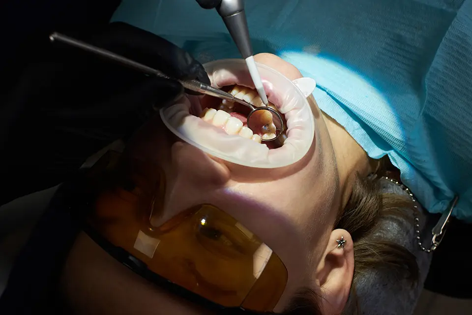 Why Don't You Wait? 5 Critical Signs You Need Third Molar Extraction Now