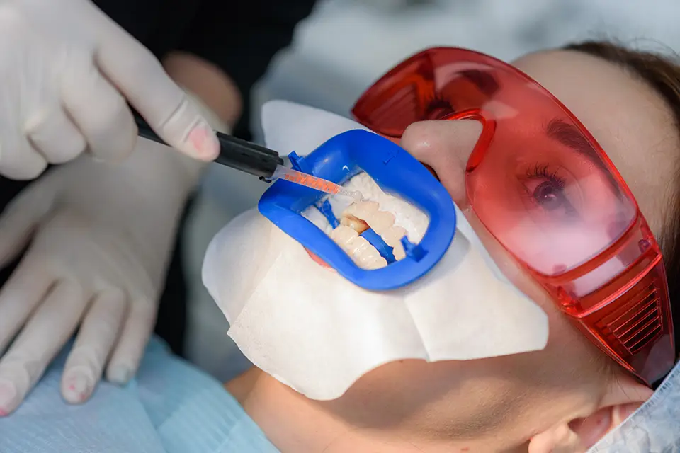 Zoom Teeth Whitening Toronto: Your Guide to Fast, Even Brightening