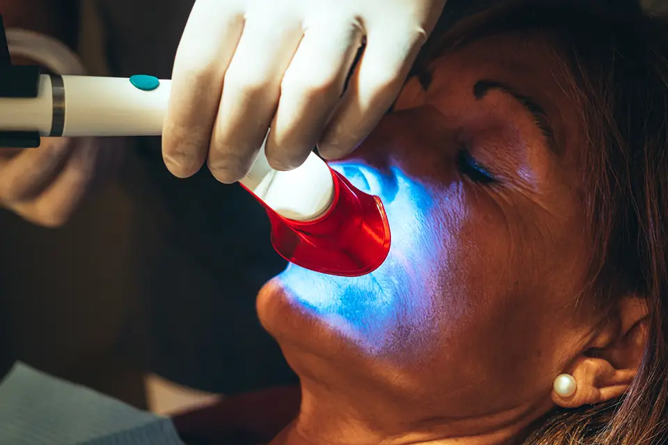 Teeth Whitening Options at Toronto Dentists: A Clear Guide for Summerhill Patients