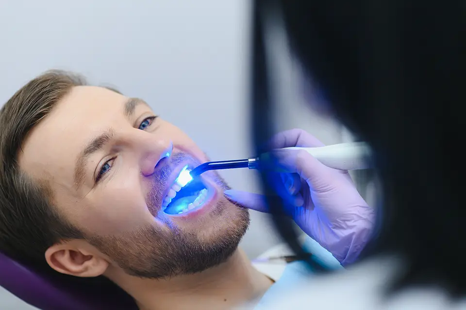 Teeth Whitening Side Effects: A 48-Hour Aftercare Plan