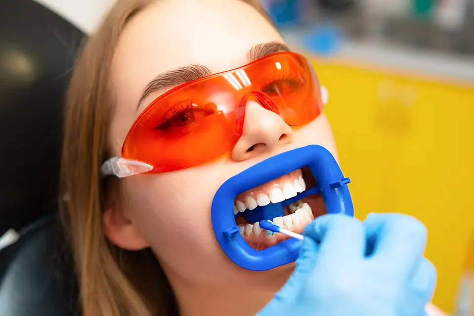 Teeth Whitening Side Effects: What's Normal, What's Not, and How to Prevent Problems