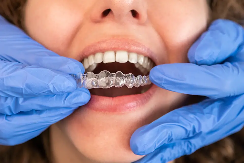Emergency Invisalign Repair Toronto Effects: What To Do When Aligners Break, Don't Fit, Or Go Missing