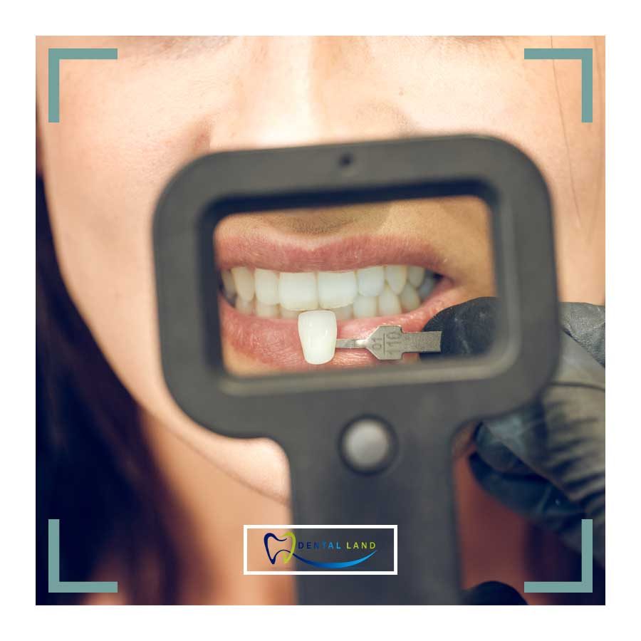 A dentist holding a frame in front of a woman's mouth, examining her teeth. They may be checking her all-porcelain or all-ceramic dental crowns