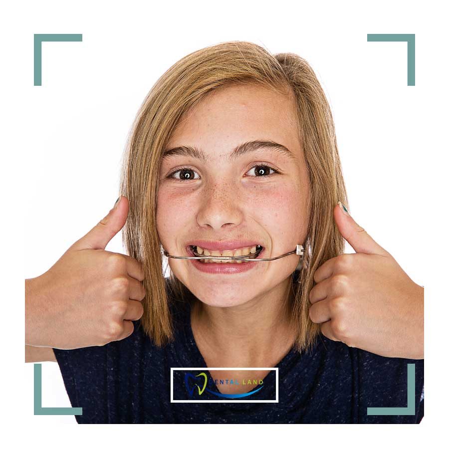 A girl with a headgear on her teeth giving a thumbs up, expressing her approval and confidence